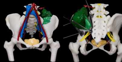 最快僅需20分鐘，解密“華西造”智能3D醫療高速打印系統